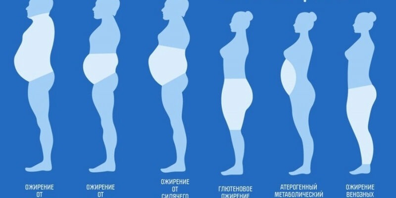 Лишний вес, ожирение. 5 причин из детства.